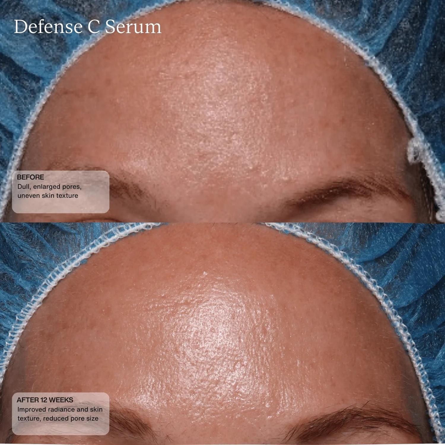 Senté Defense C Serum before and after 12 weeks showing reduced pore size improved skin texture and radiance