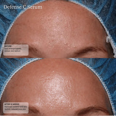 Senté Defense C Serum before and after 12 weeks showing reduced pore size improved skin texture and radiance
