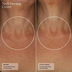 Senté Neck Firming Cream before and after 4 weeks showing visibly reduced horizontal fine lines and improved skin laxity on the neck