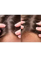 FOREO FAQ 302 Advanced Laser & Red Light Therapy for Hair Growth