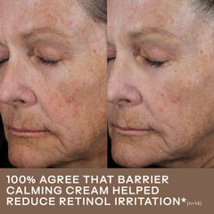 Before and after six weeks showing reduced retinol related irritation