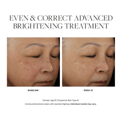 SkinMedica Even & Correct Advanced Brightening Treatment