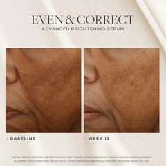 SkinMedica Even & Correct Advanced Brightening Treatment