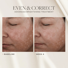SkinMedica Even & Correct Advanced Brightening Treatment