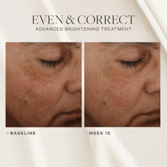 SkinMedica Even & Correct Advanced Brightening Treatment