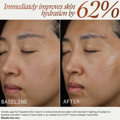 SkinMedica HA5 Hydra Collagen Facial Mist immediately improves skin hydration by 62 percent before and after results