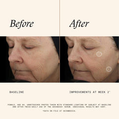 SkinMedica TNS Advanced+ Serum before and after skin improvement results at week 2