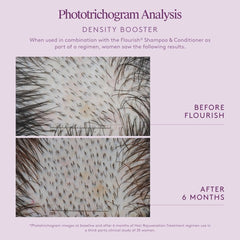 Phototrichogram scalp close-ups showing denser hair after 6 months of the Virtue Flourish Density Booster regimen