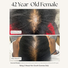 Xtresse hair growth results 42 year old before and after 3 months part width