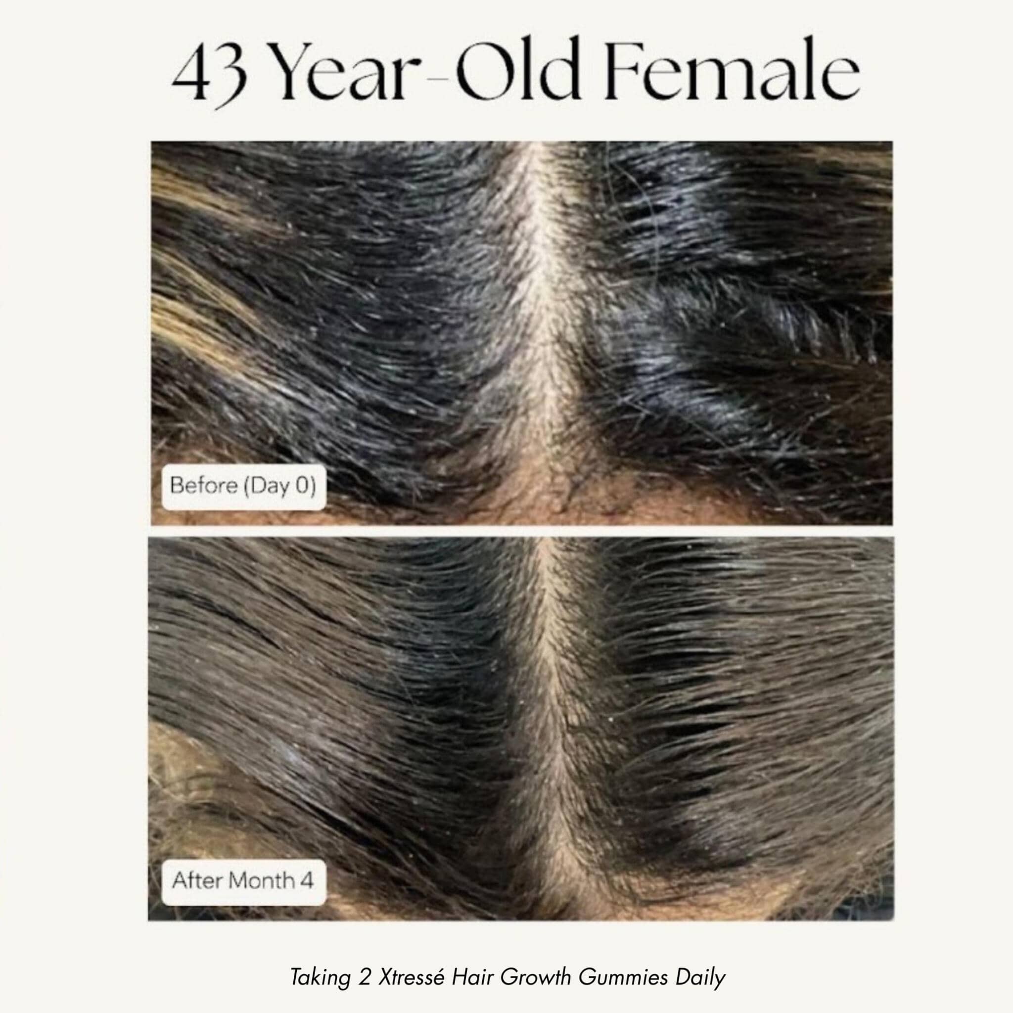 Xtresse hair growth results 43 year old before and after 4 months part density