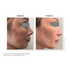 DefenAge Clinical Power Trio FRAGRANCE FREE DefenAge Shop at Exclusive Beauty