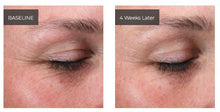Load image into Gallery viewer, Emepelle Eye Cream Emepelle Shop at Exclusive Beauty Club
