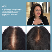 Cargar imagen en el visor de galería, Hairmax Flip 80 Laser Hair Growth Cap Hairmax Shop at Exclusive Beauty Club
