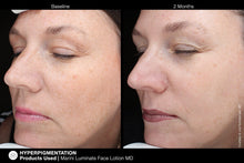 Cargar imagen en el visor de galería, Jan Marini Luminate Face Lotion MD Jan Marini Shop at Exclusive Beauty Club
