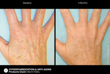 Charger l&#39;image dans la visionneuse de galerie, Jan Marini ReNu Corrective Hand Complex Jan Marini Shop at Exclusive Beauty Club
