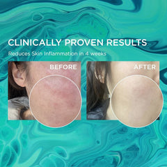 Medature Barrier Balancing Gel Moisturizer 4 Medature Shop at Exclusive Beauty