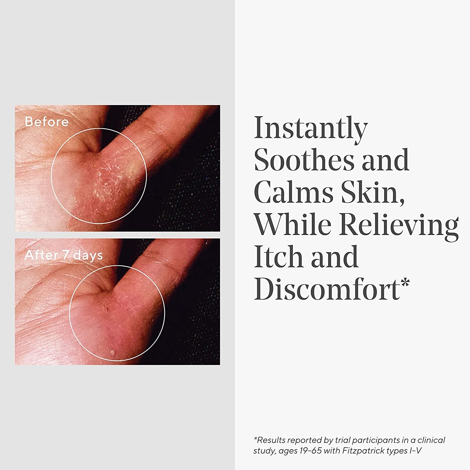 Murad Quick Relief Colloidal Oatmeal Treatment Murad Shop at Exclusive Beauty