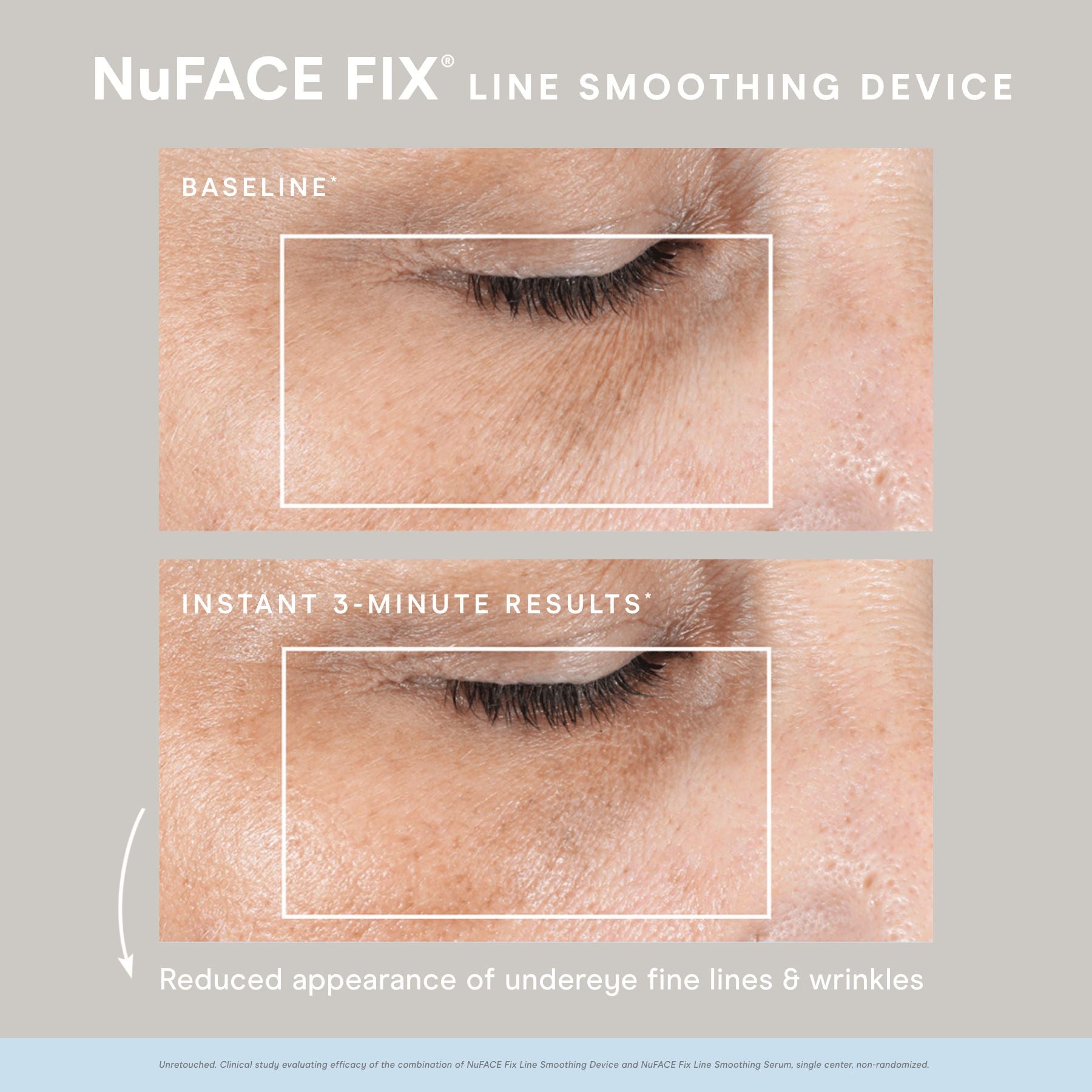 Deals NUFACE FIX new in box