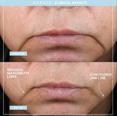 NuFACE MINI+ Starter Kit in Sandy Rose NuFACE Shop at Exclusive Beauty