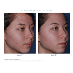 Obagi CLENZIderm M.D. System Obagi Shop at Exclusive Beauty