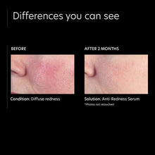 Load image into Gallery viewer, PCA Skin Anti-Redness Serum PCA Skin Shop at Exclusive Beauty Club
