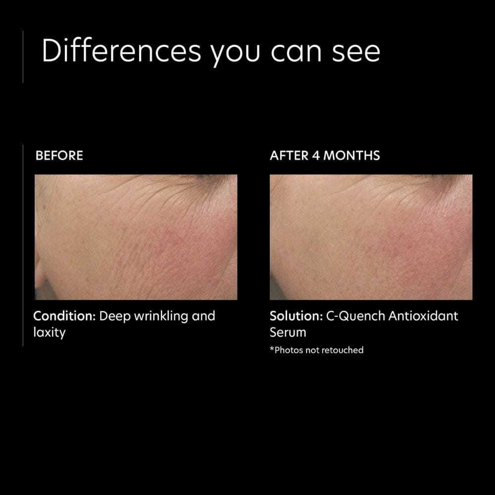 PCA Skin C-Quench Antioxidant Serum Lotion & Moisturizer PCA Skin Shop at Exclusive Beauty