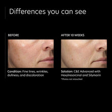 Carregar imagem no visualizador da Galeria, PCA Skin C&amp;E Advanced with Hexylresorcinol and Silymarin PCA Skin Shop at Exclusive Beauty Club
