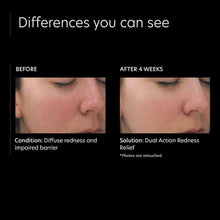Load image into Gallery viewer, PCA Skin Dual Action Redness Relief PCA Skin Shop at Exclusive Beauty Club
