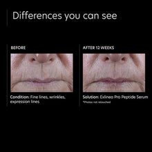 Carregar imagem no visualizador da Galeria, PCA SKIN ExLinea Pro® Peptide Serum PCA Skin Shop at Exclusive Beauty Club
