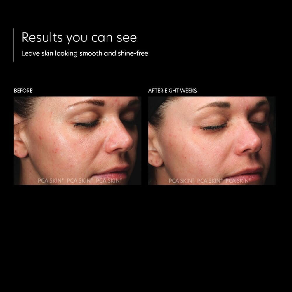 PCA Skin HydraMatte Lotion & Moisturizer PCA Skin Shop at Exclusive Beauty