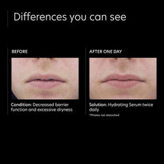 PCA Skin Hydrating Serum Lotion & Moisturizer PCA Skin Shop at Exclusive Beauty