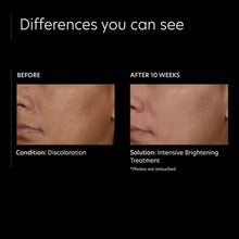 Carregar imagem no visualizador da Galeria, PCA Skin Intensive Brightening Treatment: 0.5% Pure Retinol Night PCA Skin Shop at Exclusive Beauty Club
