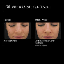 Load image into Gallery viewer, PCA Skin Intensive Clarity Treatment: 0.5% Pure Retinol Night PCA Skin Shop at Exclusive Beauty Club
