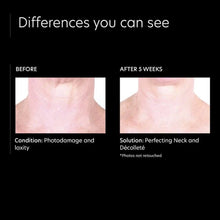 Load image into Gallery viewer, PCA Skin Perfecting Neck &amp; Decollete PCA Skin Shop at Exclusive Beauty Club
