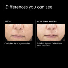 PCA Skin Pigment Gel HQ Free Lotion & Moisturizer PCA Skin Shop at Exclusive Beauty