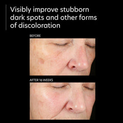 PCA Skin Pigment Gel PRO Lotion & Moisturizer PCA Skin Shop at Exclusive Beauty