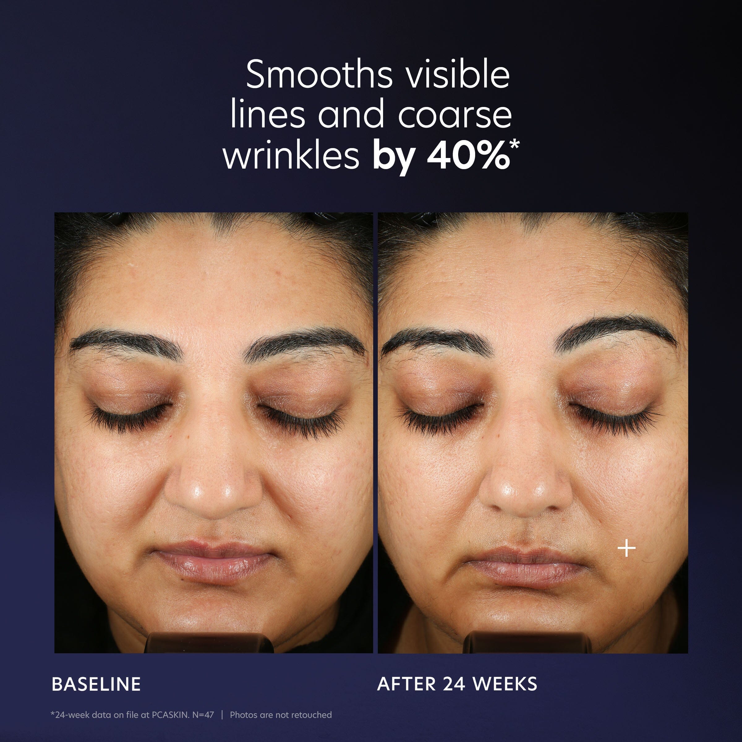 PCA Skin Pro-Max Age Renewal Advanced Anti-aging Serum Skin Care PCA Skin Shop at Exclusive Beauty