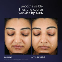 PCA Skin Pro-Max Age Renewal Advanced Anti-aging Serum Skin Care PCA Skin Shop at Exclusive Beauty