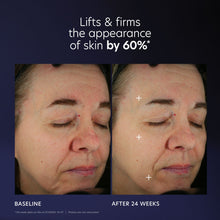 Carregar imagem no visualizador da Galeria, PCA Skin Pro-Max Age Renewal Advanced Anti-aging Serum Skin Care PCA Skin Shop at Exclusive Beauty Club
