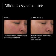 PCA Skin Retinol Treatment for Sensitive Skin Lotion & Moisturizer PCA Skin Shop at Exclusive Beauty