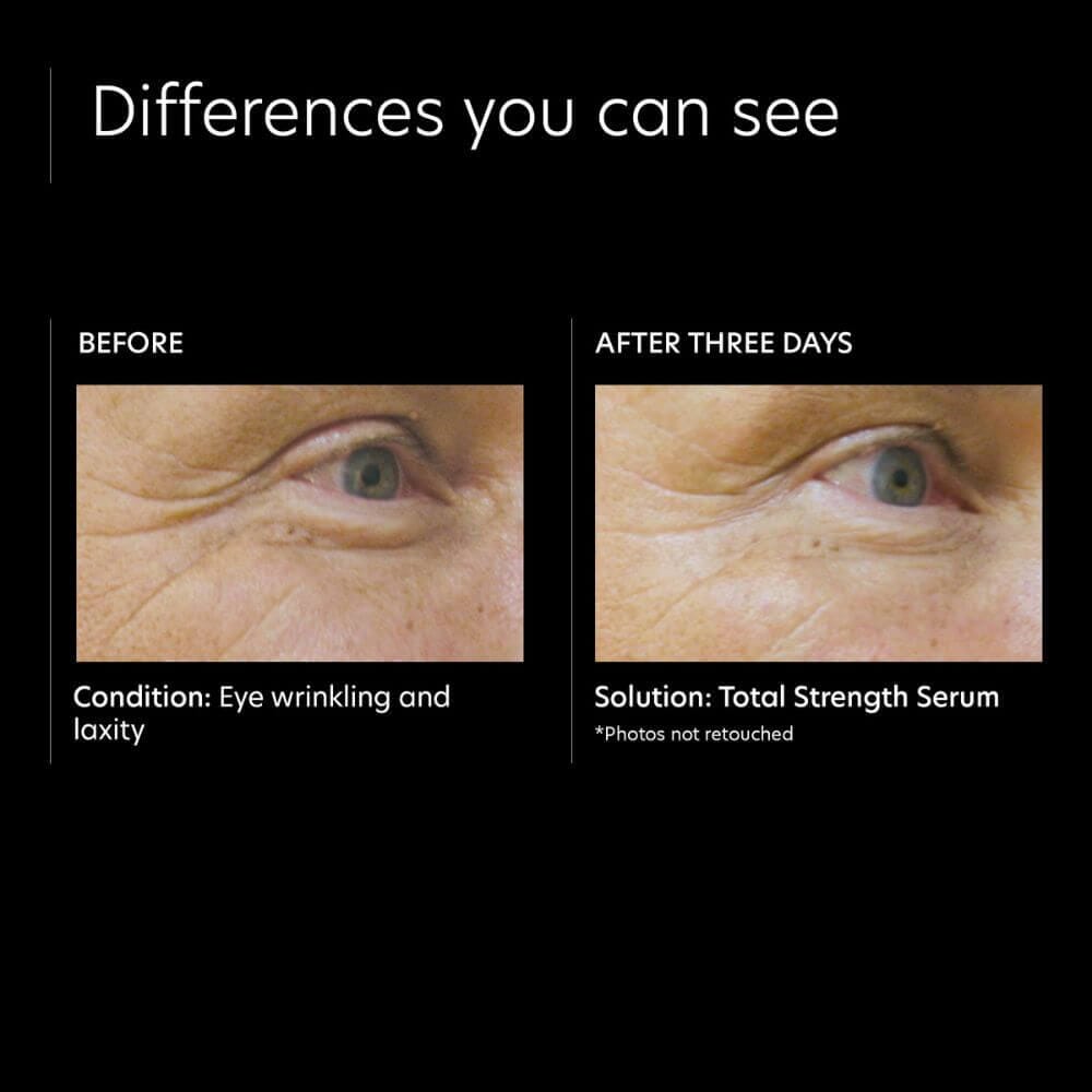 PCA Skin Total Strength Serum Lotion & Moisturizer PCA Skin Shop at Exclusive Beauty