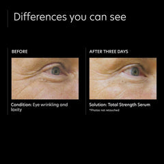 PCA Skin Total Strength Serum Lotion & Moisturizer PCA Skin Shop at Exclusive Beauty