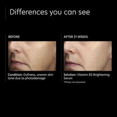PCA Skin Vitamin B3 Brightening Serum Lotion & Moisturizer PCA Skin Shop at Exclusive Beauty