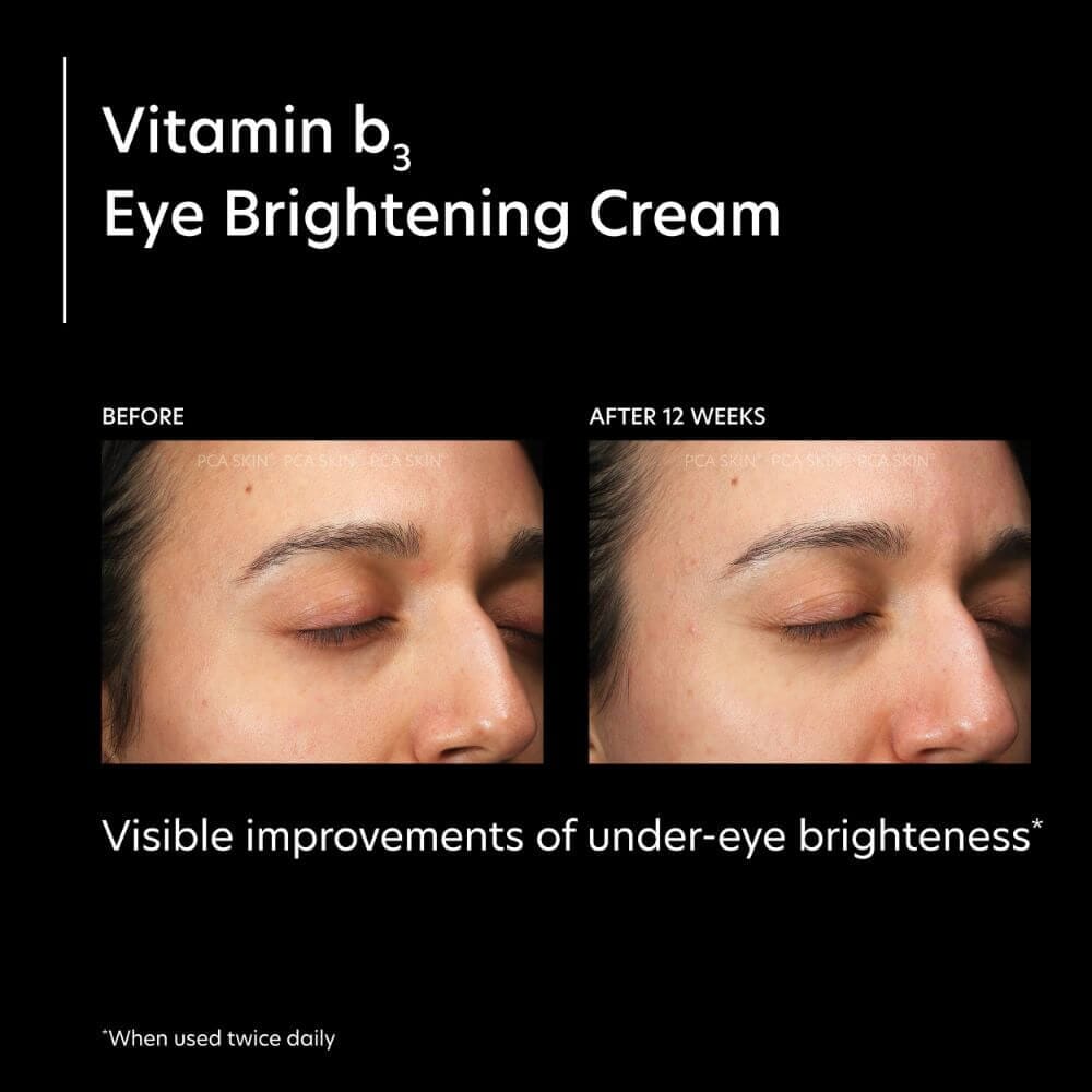 PCA Skin Vitamin B3 Eye Brightening Cream Lotion & Moisturizer PCA Skin Shop at Exclusive Beauty Club