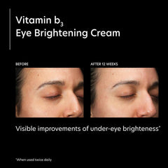 PCA Skin Vitamin B3 Eye Brightening Cream Eye Creams PCA Skin Shop at Exclusive Beauty