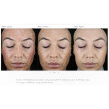 Cargar imagen en el visor de galería, Plated Skin Science CALM Post-Procedure Serum Plated Skin Science Shop at Exclusive Beauty Club
