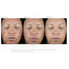 Load image into Gallery viewer, Plated Skin Science CALM Post-Procedure Serum Plated Skin Science Shop at Exclusive Beauty Club
