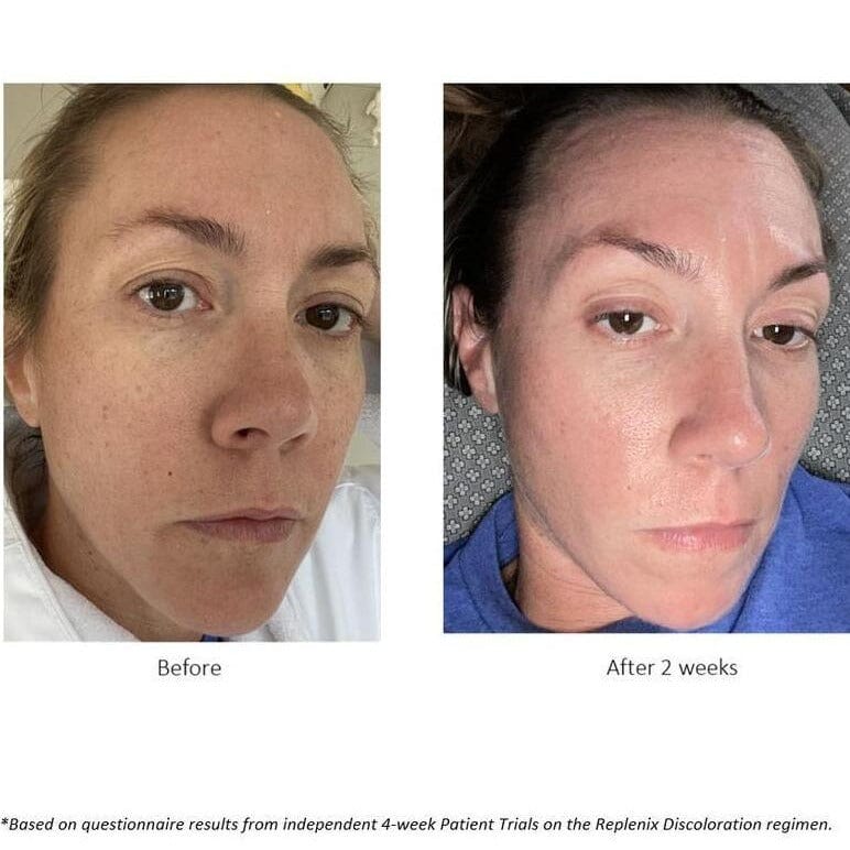 Replenix Glycolic Acid 10% Resurfacing Peel Pads Replenix Shop at Exclusive Beauty