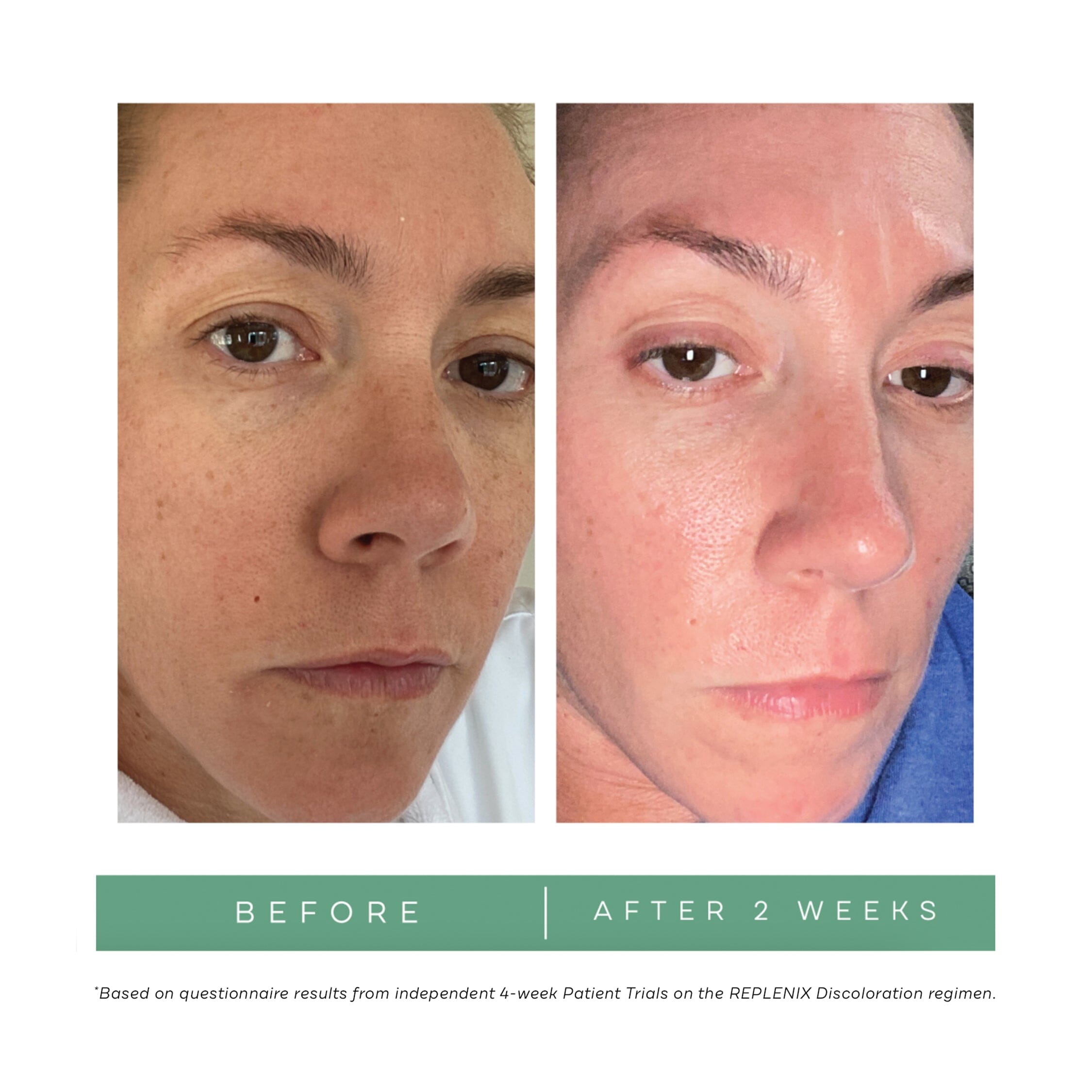 Replenix Vitamin C Pro Collagen Serum Replenix Shop at Exclusive Beauty