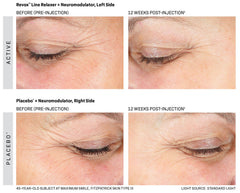 Revision Skincare Revox Line Relaxer Revision Shop at Exclusive Beauty